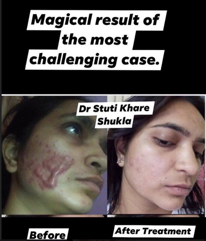 After Skin Clearing