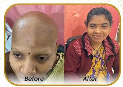 After Hair Growth